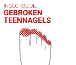 INGEGROEIDE / GEBROKEN TEENNAGELS